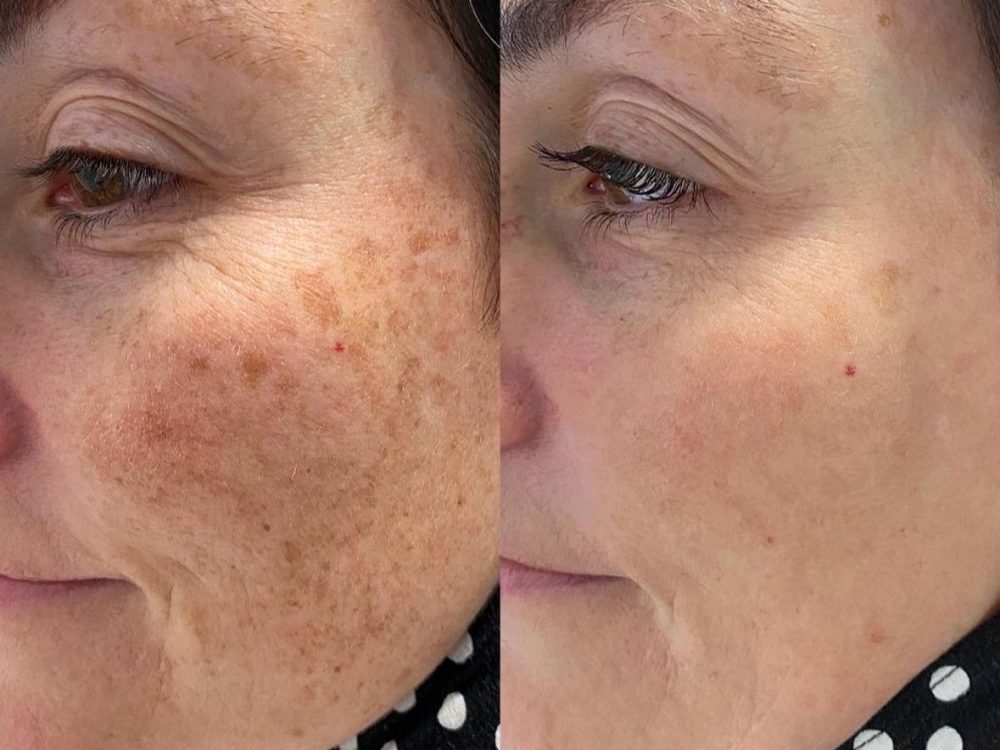 WhatsApp Image 2024-12-05 at 18.23.28