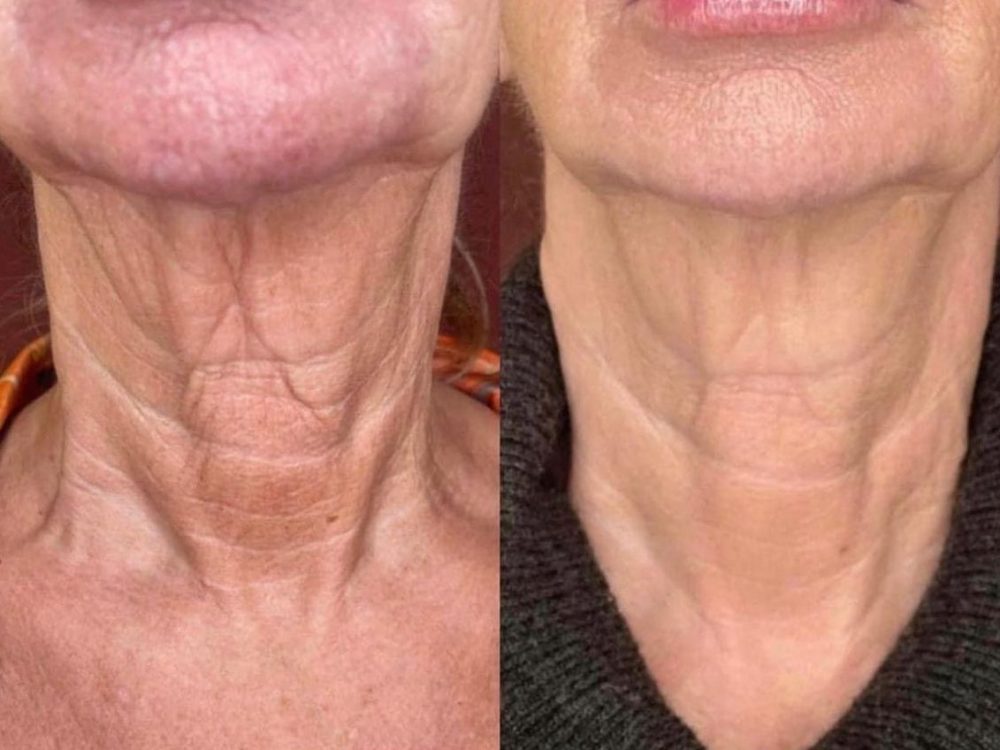 WhatsApp Image 2024-12-05 at 18.23.30 (2)